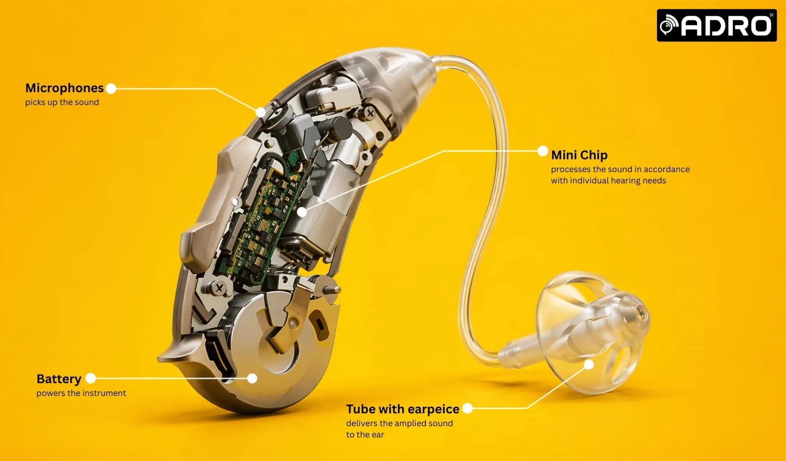 92 The Different Hearing Aid Parts That You Need To Know